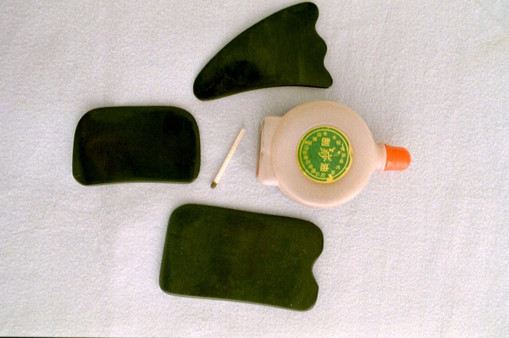 Gua Sha at Alchemy Clinic STL